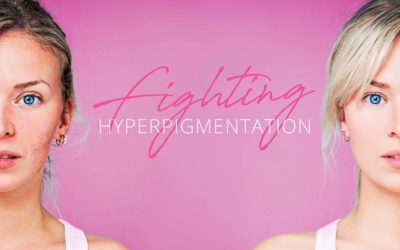 Reducing Hyperpigmentation with Beauty Society
