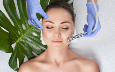 What are the cons of laser resurfacing and alternatives?